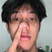B